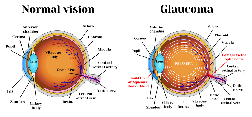 Anatomy of the Eye - Retina-Vitreous Surgeons of CNY